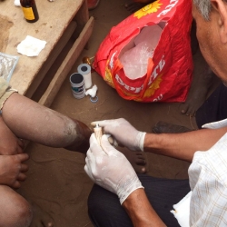 Atendimento a crianças em Chavundira, Tete e Moçambique, na África